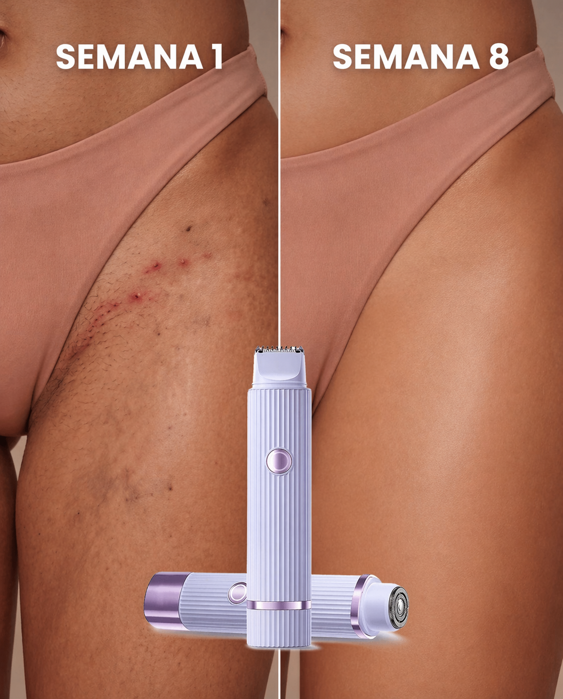 LissPro™ Depilador Elétrico - Facial e Corporal À Prova d'Água + Brindes Exclusivos